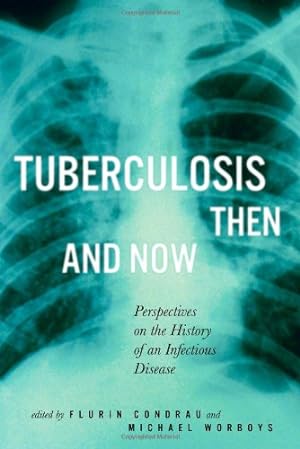 Seller image for Tuberculosis Then and Now: Perspectives on the History of an Infectious Disease (McGill-Queens/Associated Medical Services Studies in the History of Medicine, H) by Condrau, Flurin, Worboys, Michael [Paperback ] for sale by booksXpress