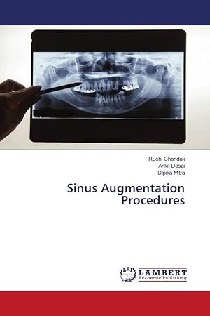 Imagen del vendedor de Sinus Augmentation Procedures a la venta por moluna