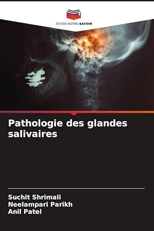 Seller image for Pathologie des glandes salivaires for sale by moluna