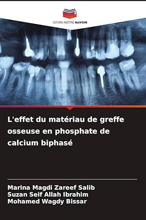 Seller image for L\ effet du matriau de greffe osseuse en phosphate de calcium biphas for sale by moluna