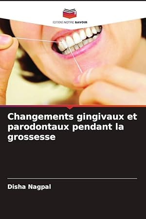 Bild des Verkufers fr Changements gingivaux et parodontaux pendant la grossesse zum Verkauf von moluna