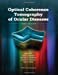 Image du vendeur pour Optical Coherence Tomography of Ocular Diseases [Hardcover ] mis en vente par booksXpress