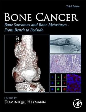 Bild des Verkufers fr Bone Cancer : Bone Sarcomas and Bone Metastases From Bench to Bedside zum Verkauf von AHA-BUCH GmbH
