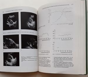 Ultraschall in der Medizin. - 1. Jahrgang / 1980.