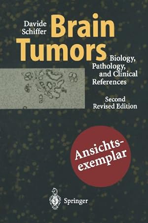 Bild des Verkufers fr Brain Tumors: Biology, Pathology and Clinical References by Schiffer, Davide [Paperback ] zum Verkauf von booksXpress