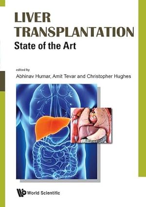 Seller image for Liver Transplantation: State of the Art by Abhinav Humar [Hardcover ] for sale by booksXpress