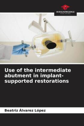 Bild des Verkufers fr Use of the intermediate abutment in implant-supported restorations zum Verkauf von moluna