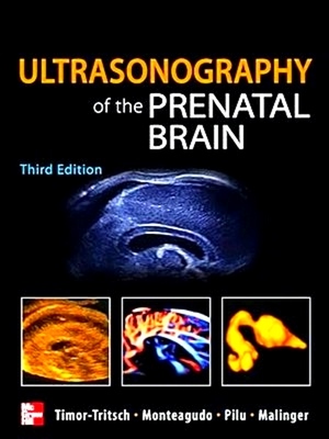 Image du vendeur pour Ultrasonography of the Prenatal Brain mis en vente par Collectors' Bookstore