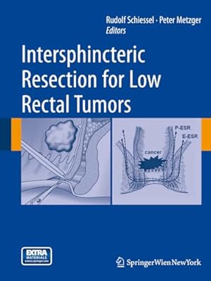 Imagen del vendedor de Intersphincteric Resection for Low Rectal Tumors a la venta por WeBuyBooks