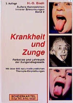 Seller image for Antlitzdiagnostik: uere Kennzeichen innerer Erkrankungen, Bd.2, Krankheit und Zunge for sale by Studibuch