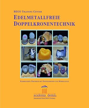 Seller image for Edelmetallfreie Doppelkronentechnik: Kombinierte Prothese mit Doppelkronen und Modellguss Kombinierte Prothese mit Doppelkronen und Modellguss for sale by Antiquariat Mander Quell