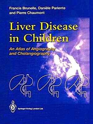 Seller image for Liver Disease in Children: An Atlas of Angiography and Cholangiography for sale by Collectors' Bookstore