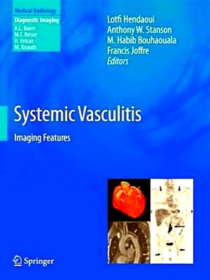 Seller image for Systemic Vasculitis for sale by Collectors' Bookstore