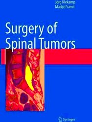 Immagine del venditore per Surgery of Spinal Tumors venduto da Collectors' Bookstore