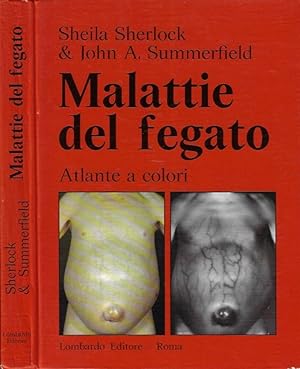 Bild des Verkufers fr Malattie del fegato Atlante a colori zum Verkauf von Biblioteca di Babele