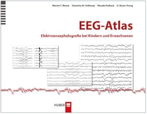 Immagine del venditore per EEG-Atlas : Elektroenzephalografie bei Kindern und Erwachsenen venduto da AHA-BUCH GmbH