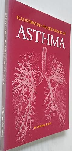 Illustrated Pocketbook of Asthma