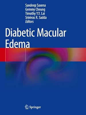 Bild des Verkufers fr Diabetic Macular Edema zum Verkauf von AHA-BUCH GmbH