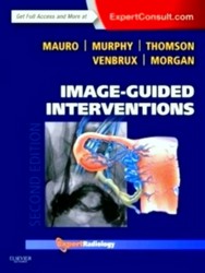 Bild des Verkufers fr Image-Guided Interventions: Expert Radiology Series zum Verkauf von Collectors' Bookstore