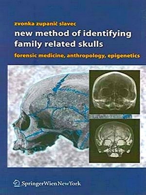 Bild des Verkufers fr New Methods of Identifying Family Related Skulls zum Verkauf von Collectors' Bookstore