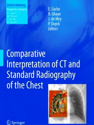 Immagine del venditore per Comparative Interpretation of CT and Standard Radiography of the Chest venduto da Collectors' Bookstore