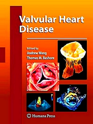 Image du vendeur pour Valvular Heart Disease mis en vente par Collectors' Bookstore
