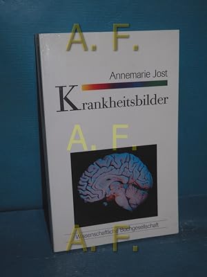 Seller image for Krankheitsbilder Wissenschaftliche Buchgesellschaft: WB-Forum 55 for sale by Antiquarische Fundgrube e.U.