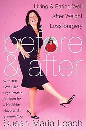 Seller image for Before and After: Living and Eating Well after Weight Loss Surgery for sale by WeBuyBooks 2