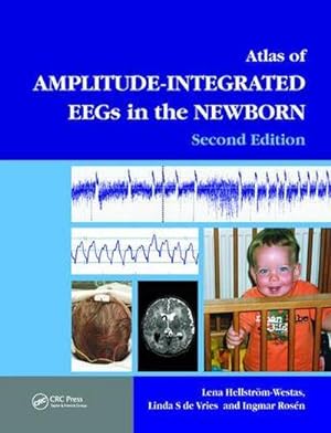 Bild des Verkufers fr An Atlas of Amplitude-Integrated EEGs in the Newborn zum Verkauf von AHA-BUCH GmbH