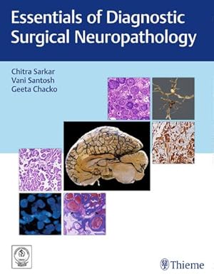 Bild des Verkufers fr Essentials of Diagnostic Surgical Neuropathology zum Verkauf von Rheinberg-Buch Andreas Meier eK
