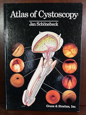 Atlas of Cystoscopy