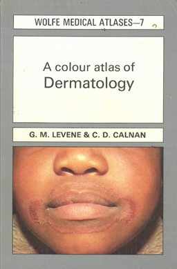 A colour atlas of Dermatology.