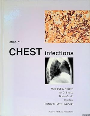 Bild des Verkufers fr Atlas of Chest Infections zum Verkauf von Klondyke