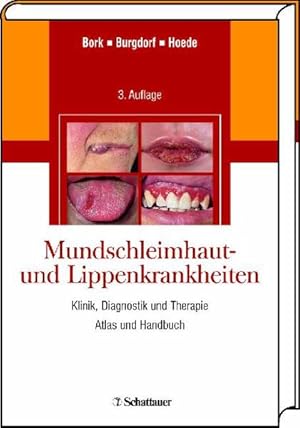 Seller image for Mundschleimhaut- und Lippenkrankheiten: Klinik, Diagnostik und Therapie Atlas und Handbuch for sale by Studibuch