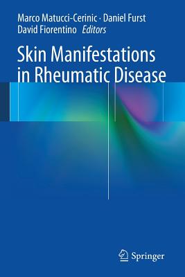 Image du vendeur pour Skin Manifestations in Rheumatic Disease (Paperback or Softback) mis en vente par BargainBookStores