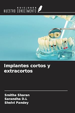 Seller image for Implantes cortos y extracortos for sale by moluna