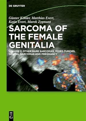 Immagine del venditore per Sarcoma of the Female Genitalia / [Set Vol. I+II] Bd. Volume 1+2 venduto da moluna