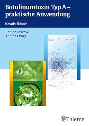 Bild des Verkufers fr Botulinum Neurotoxin Typ A: Kasuistikbuch zum Verkauf von Studibuch