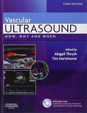 Bild des Verkufers fr Vascular Ultrasound: How, Why and When zum Verkauf von WeBuyBooks