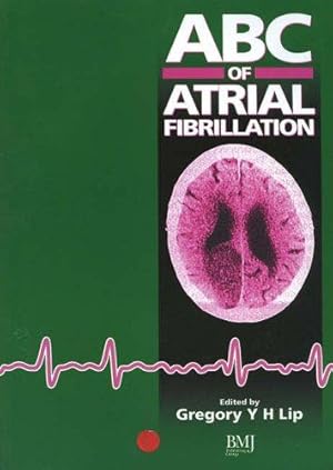 Seller image for ABC of Atrial Fibrillation (ABC Series) for sale by WeBuyBooks