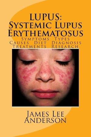 Immagine del venditore per LUPUS: Systemic Lupus Erythematosus: Symptoms. Types. Causes. Diet. Diagnosis. Treatments. Research. venduto da WeBuyBooks 2