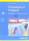 Ortodoncia Lingual