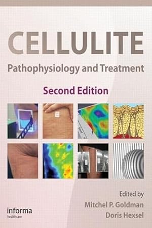 Imagen del vendedor de Cellulite: Pathophysiology and Treatment: 1 (Basic and Clinical Dermatology) a la venta por WeBuyBooks
