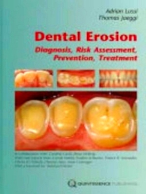 Immagine del venditore per Dental Erosion Special Collection venduto da Collectors' Bookstore