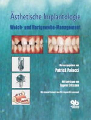 Bild des Verkufers fr sthetische Implantologie: Weich- und Hartgewebe-Management zum Verkauf von Studibuch