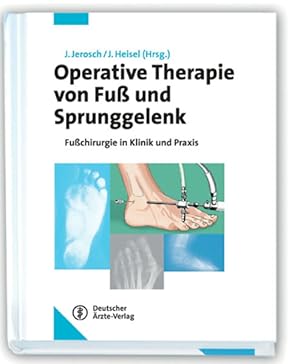 Imagen del vendedor de Operative Therapie von Fu und Sprunggelenk: Fuchirurgie in Klinik und Praxis a la venta por Studibuch