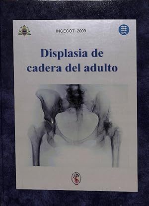 Imagen del vendedor de DISPLASIA DE CADERA DEL ADULTO. INGECOT 2009 a la venta por Librera Smile Books
