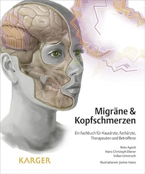 Bild des Verkufers fr Migrne und Kopfschmerzen: Ein Fachbuch fr Hausrzte, Fachrzte, Therapeuten und Betroffene zum Verkauf von Studibuch