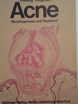 Bild des Verkufers fr Acne : morphogenesis and treatment. Gerd Plewig; Albert M. Kligman zum Verkauf von Herr Klaus Dieter Boettcher
