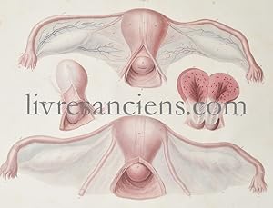 Seller image for Trait pratique des maladies de l'utrus et de ses annexes fond sur un grand nombre d'observations cliniques - ATLAS for sale by Eric Zink Livres anciens